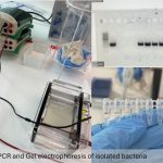 Colony PCR and gel electrophoresis of isolated bacteria